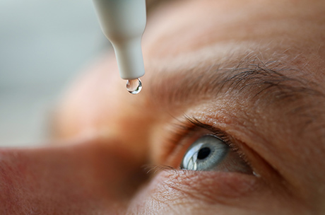 Applying eye drops to dry eye