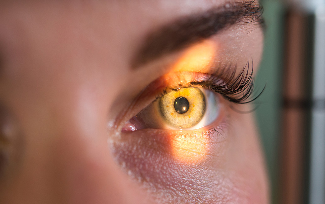 Close up of eye during an eye exam