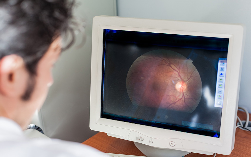 Dr Looking at Retinal Image from Optos Machine